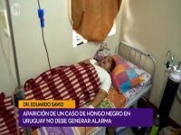 Dr. Savio hongo negro