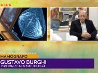 Gustavo Burghi Mamógrafo.00_00_14_00.Imagen fija002